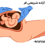زایمان-سزارین