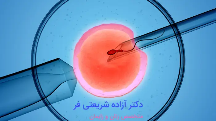 درمان ناباروری با آی یو آی IUI